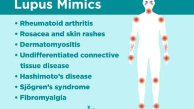 5 olahraga yang bisa dilakukan pengidap fibromyalgia