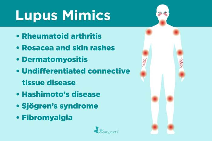 5 olahraga yang bisa dilakukan pengidap fibromyalgia