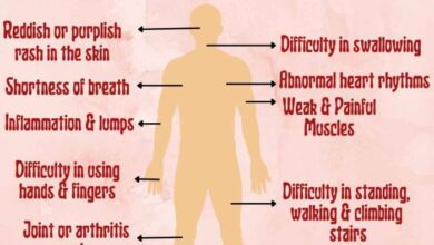 5 gejala myositis yang perlu diketahui