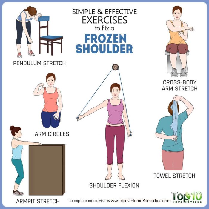 5 pengobatan yang mesti dijalani pengidap frozen shoulder
