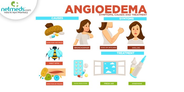 2 pencegahan angioedema yang bisa dilakukan