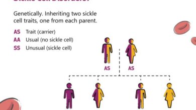 5 fakta mengenai anemia sel sabit