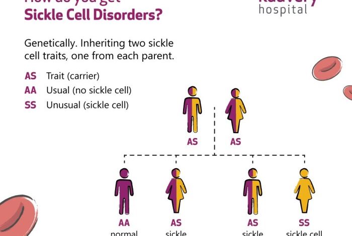 5 fakta mengenai anemia sel sabit