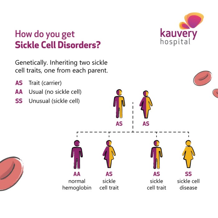 5 fakta mengenai anemia sel sabit