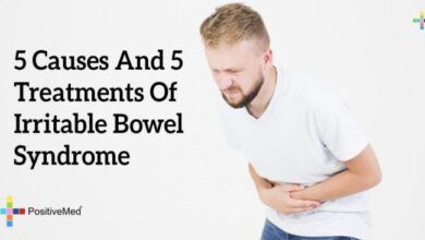 5 pengobatan untuk atasi sindrom iritasi usus