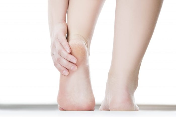 5 hal yang perlu diketahui tentang tarsal tunnel syndrome