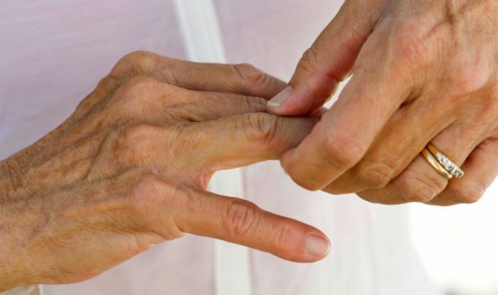 5 gerakan sederhana untuk redakan arthritis