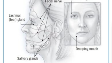 2 tes yang digunakan untuk mendeteksi bell s palsy