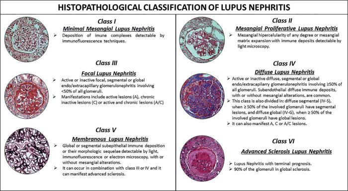 5 hal yang memicu kambuhnya gejala lupus nefritis