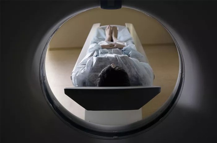 5 pemeriksaan untuk mendeteksi anthrax