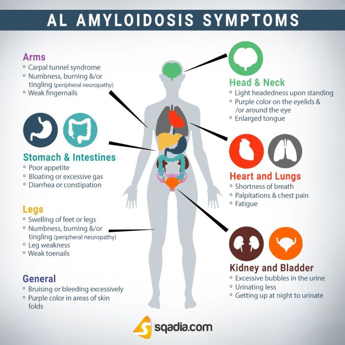 5 jenis amiloidosis yang sebabkan kerusakan organ