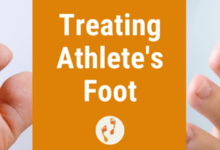 5 perawatan sederhana untuk mencegah kutu air