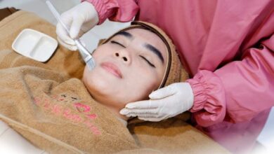 5 manfaat prosedur chemical peeling untuk kulit berjerawat