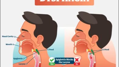 2 jenis disfagia penyakit yang sebabkan gangguan menelan