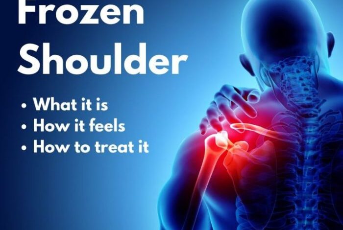 5 pengobatan yang mesti dijalani pengidap frozen shoulder