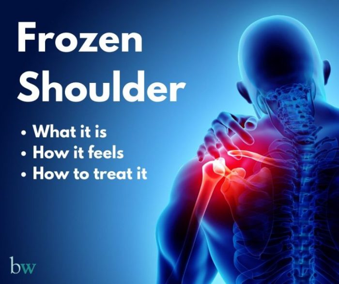 5 pengobatan yang mesti dijalani pengidap frozen shoulder