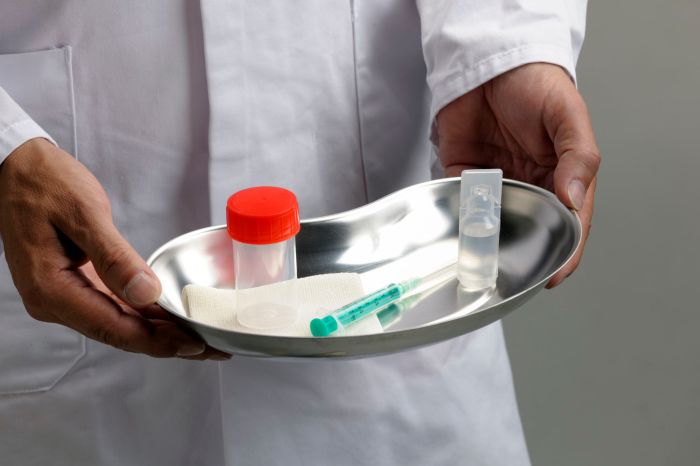 5 pilihan dokter yang bisa bantu mengobati sifilis