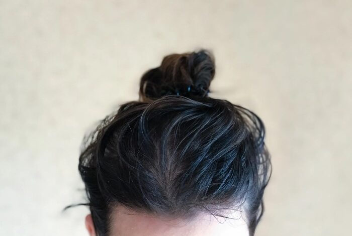 5 penyebab rambut berminyak dan solusinya