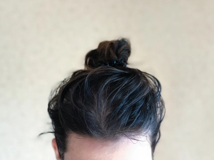 5 penyebab rambut berminyak dan solusinya