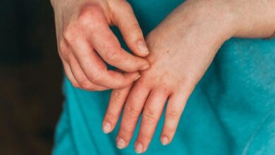 5 penyakit yang bisa jadi penyebab tangan dingin