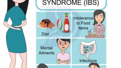 5 gejala munculnya sindrom iritasi usus