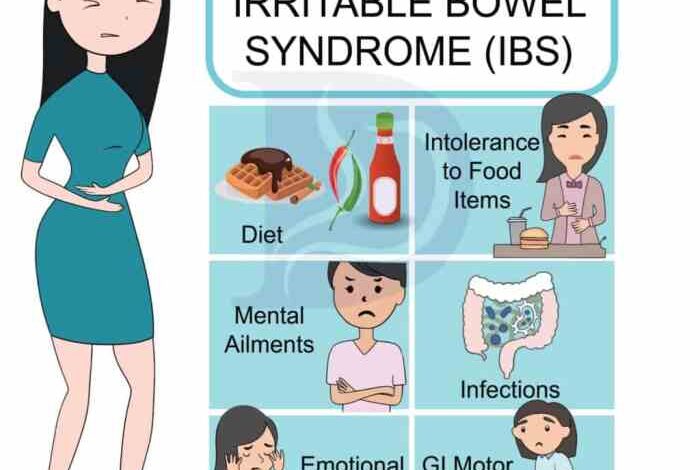 5 gejala munculnya sindrom iritasi usus