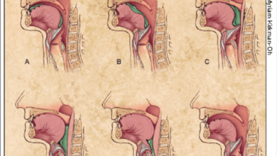 2 penyebab utama seseorang mengalami tongue swallowing