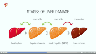 5 penyebab infeksi liver yang perlu diwaspadai