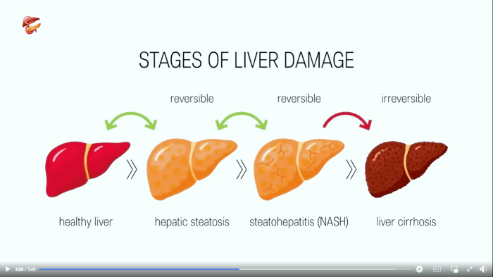 5 penyebab infeksi liver yang perlu diwaspadai