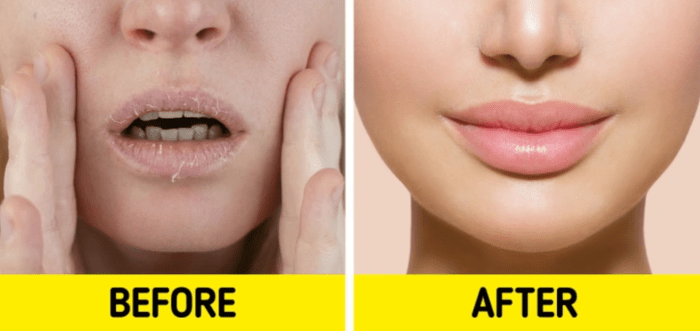 5 cara mudah atasi bibir kering coba yuk