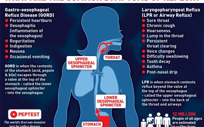 5 penyebab gastritis yang perlu diketahui
