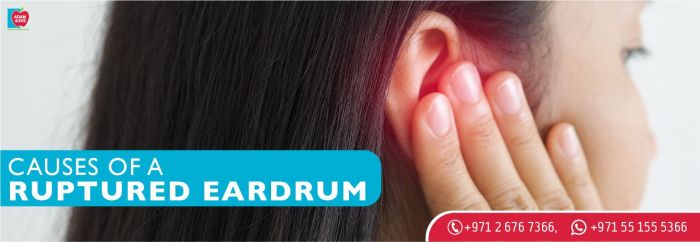 5 penyebab terjadinya perforasi membran timpani