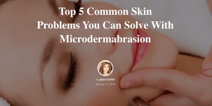 5 masalah kulit yang bisa diatasi dengan mikrodermabrasi