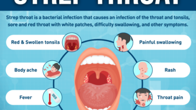 5 cara pencegahan agar tidak terkena infeksi streptococcus