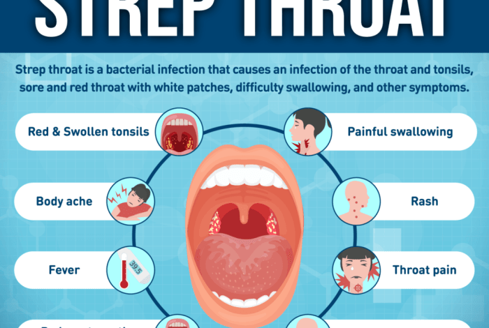 5 cara pencegahan agar tidak terkena infeksi streptococcus