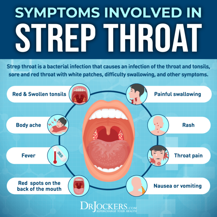 5 cara pencegahan agar tidak terkena infeksi streptococcus