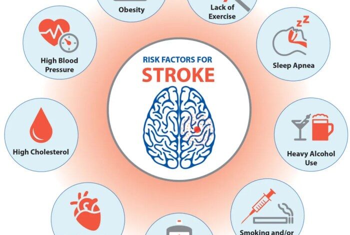 5 gaya hidup sehat untuk cegah stroke di usia muda