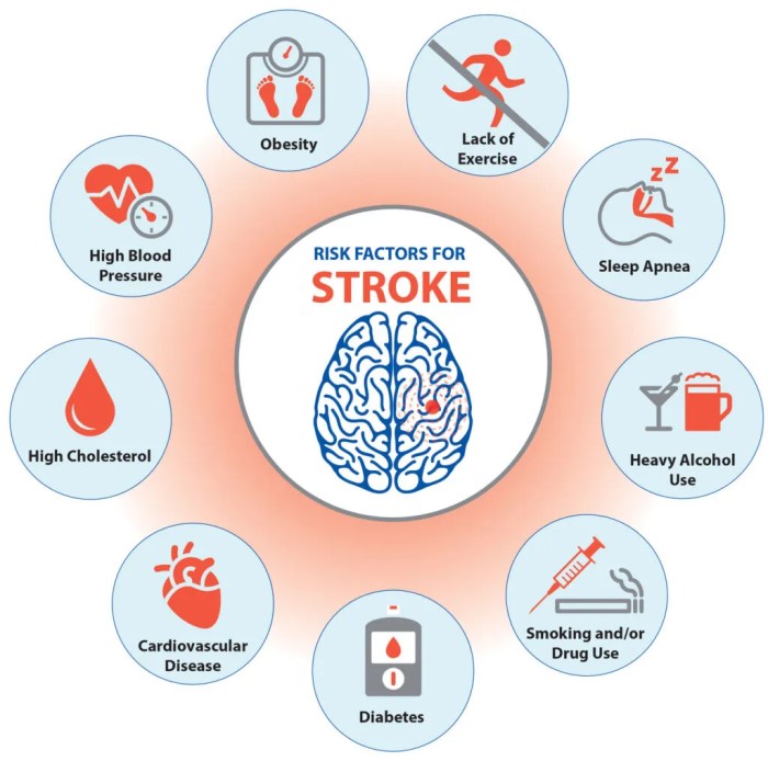 5 gaya hidup sehat untuk cegah stroke di usia muda