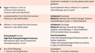 2 faktor dan cara menangani retinoblastoma