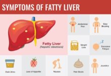 5 makanan yang sebabkan penyakit liver pada tubuh