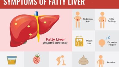 5 makanan yang sebabkan penyakit liver pada tubuh