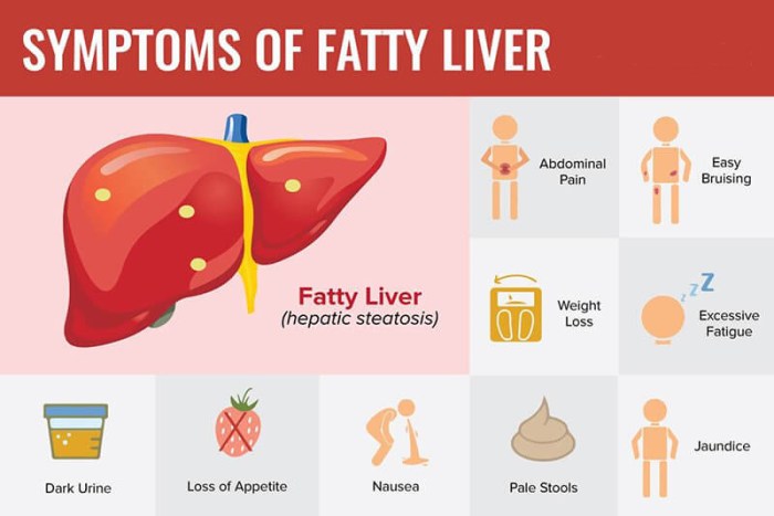 5 makanan yang sebabkan penyakit liver pada tubuh