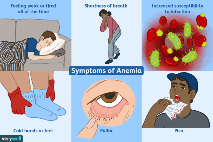 5 dokter spesialis penyakit dalam yang bisa bantu atasi gejala anemia