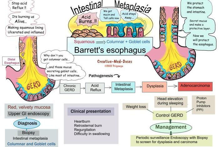 5 faktor penyebab barrett s esophagus yang perlu dipahami 1