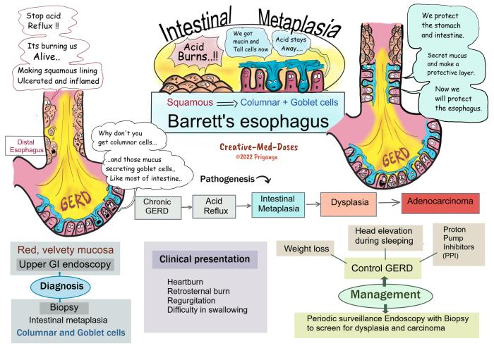 5 faktor penyebab barrett s esophagus yang perlu dipahami 1