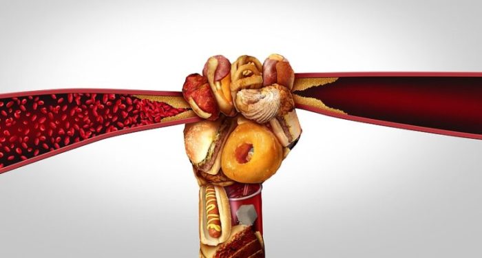 5 prosedur untuk mendiagnosis arteriosklerosis