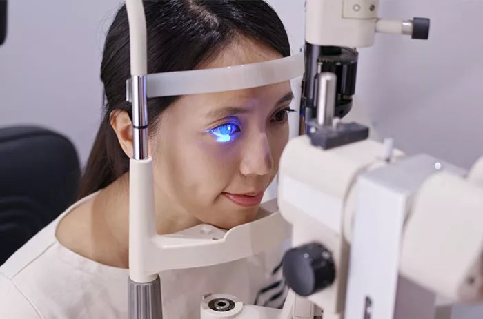 5 faktor risiko sebabkan floppy eyelid syndrome