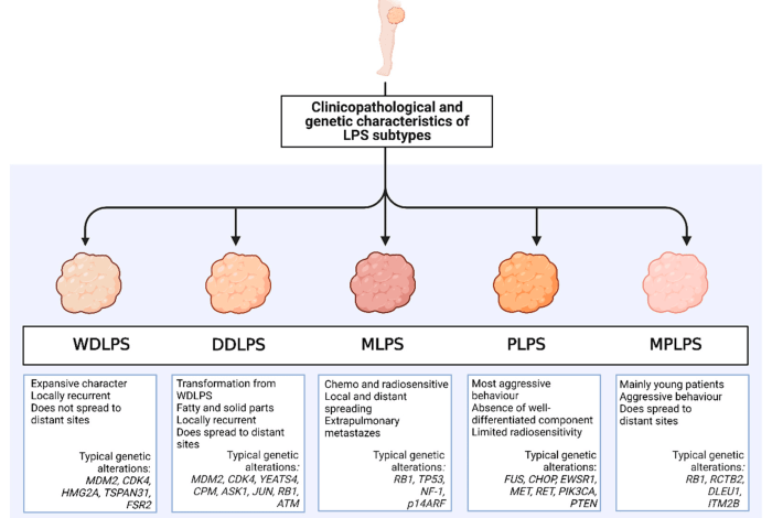 2 jenis terapi untuk atasi kondisi liposarcoma