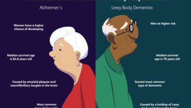 5 fakta tentang lewy body dementia yang terjadi pada lansia