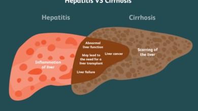 2 perbedaan hepatitis dan sirosis hati